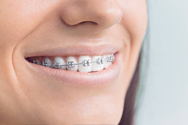 Best Full Mouth Reconstruction  in White Settlement, TX